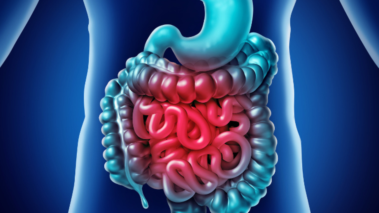 Intestine Pain and gastrointestnal digestion inflammation problem as digestion discomfort or constipation and infection as a3D illustration.