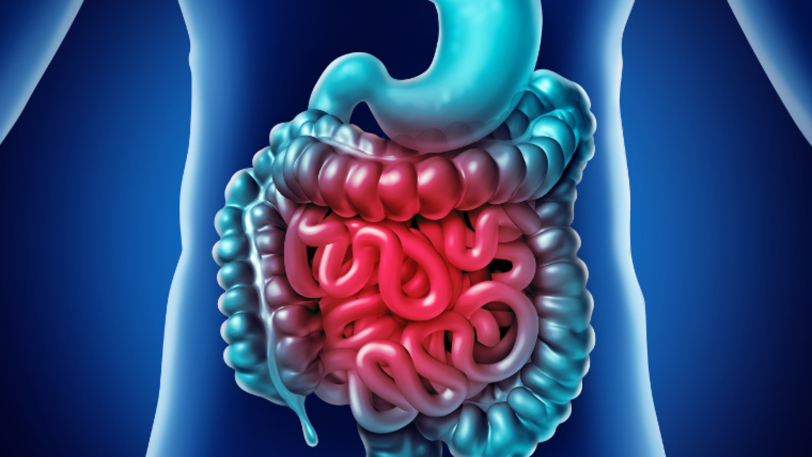 Intestine Pain and gastrointestnal digestion inflammation problem as digestion discomfort or constipation and infection as a3D illustration.